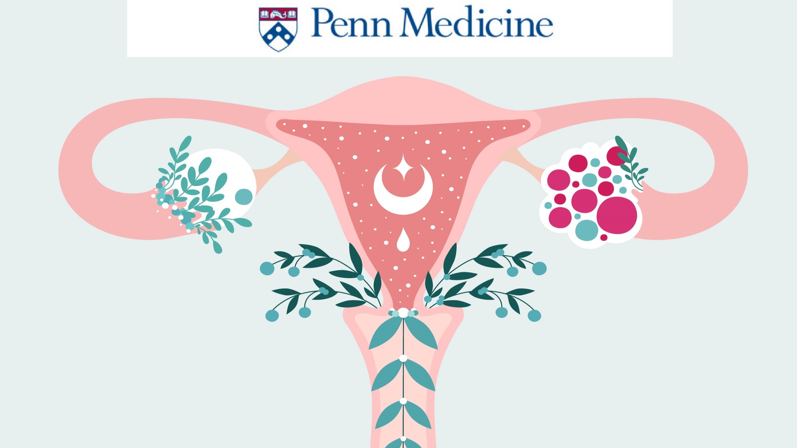 CORS-PCOS